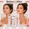 4-in-1 Electric Hair Remover for Face & Body – USB