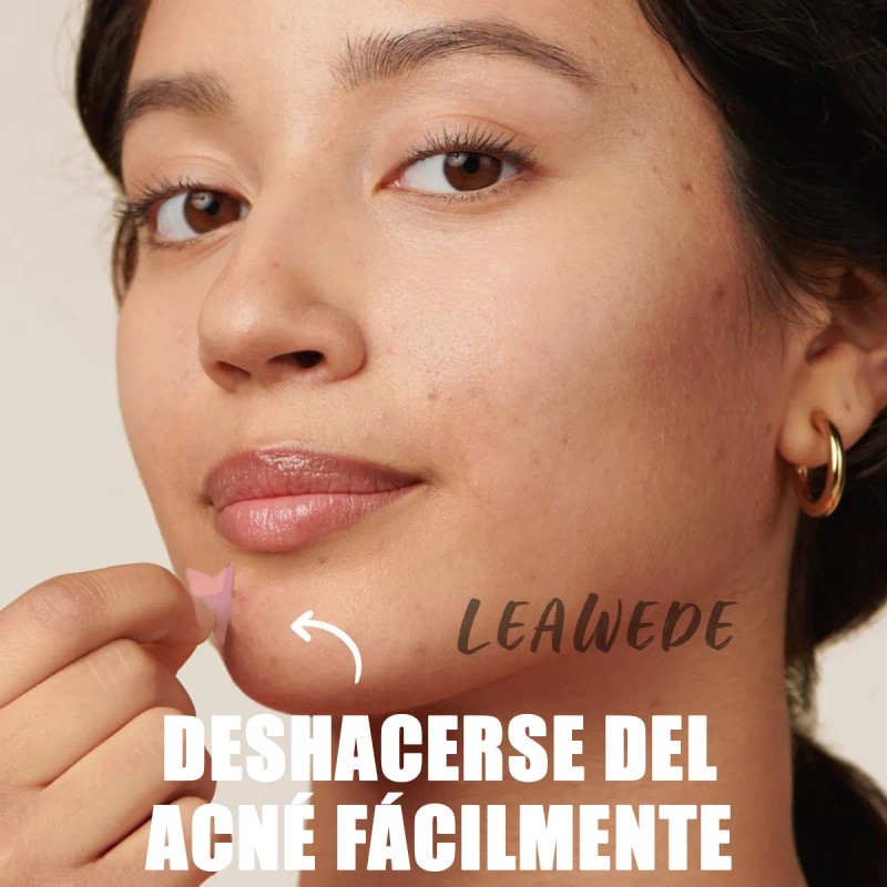 🔥 240pzs mascarillas estrella para el acne espinillas granos Vitaminas
