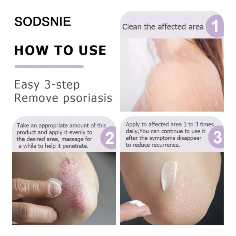 Crema F Para Psoriasis Y Cuidado De La Piel Ayurvédico