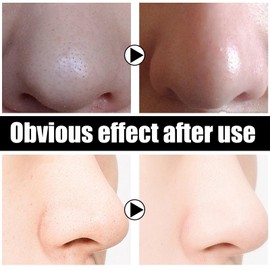 Nose Plant Pore Strips Blackhead Remover Lanbenaa Nose Plants Pore Strips Mitesserentferner Maske, Anti Mitesser Nasenmaske Mit 120 Blatt Papierstreifen, Tiefenreinigende Schönheit Haut Gesichtspflege