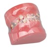Demonstration Orthodontics Dental Model Disassembled Resin Teeth Model for Teaching