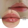 REVOX B77 Lip Filler Hyaluronic Acid 12 ml