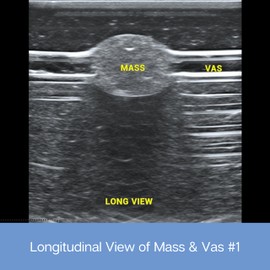 Ultrasound Practice Pad; Ultrasound Training Model for Needle Insertion Practice – Vascular and Nerve Simulation Pad for Medical Education (Vascular & Mass pad)