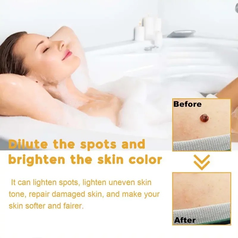 2* Crema Eliminadora De Verrugas Trivializa La Piel Y Las