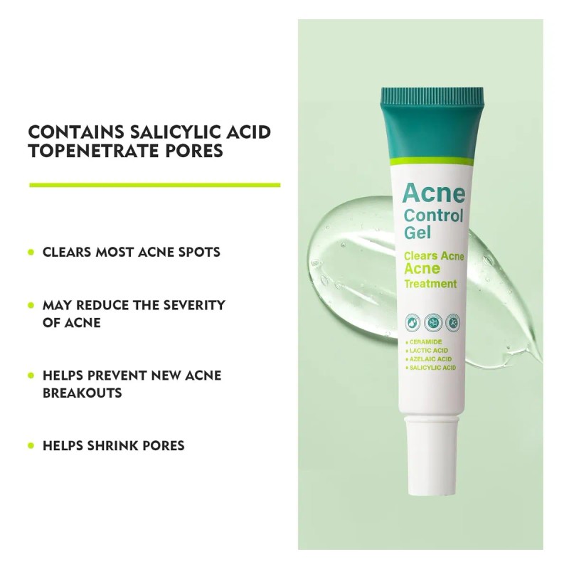 Suero De Ácido Azelaico, Gel Para Tratamiento Del Acné, Ácid