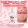 Loción Secante Antiacné Ácido Salicílico 10ml Oukeya