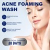 Akne Clean Foam Cleanser, 156 G Acne Foaming Wash Akne