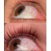 Versox Estimulador Crecimiento Pestañas Cejas