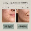 Elementa Toallas Faciales Secas Extra Grandes Desechables Rostro Limpio Bacterias