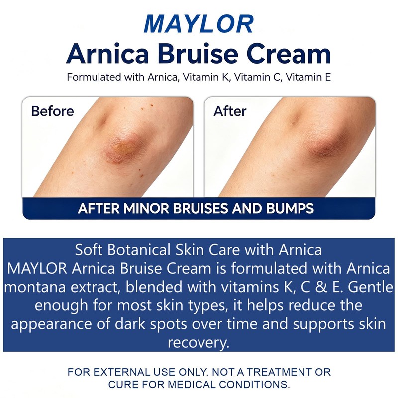Arnica Bruise Cream for Thin Sensitive Skin on Arms &