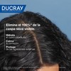 DUCRAY Kelual Squanorm Shampoo Tratante, Para Caspa Seca, 200 ml