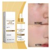 Sérum Facial Rice Essence Para Arrugas Que Hidrata Los Poros