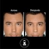 Kit Anti Ojeras Y Arrugas Roll On + Serum Antiedad