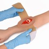 MedEduQuest Open Fracture Wound Packing Trainer, Wound Dressing Training Model,