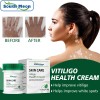 Vitíligo Aceite White Vitíligo Para 4×crema T