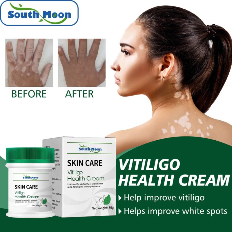 Vitíligo Aceite White Vitíligo Para 4×crema T