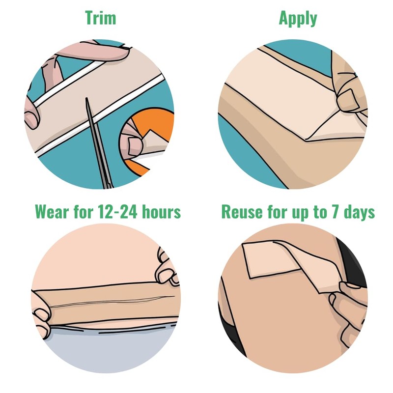 NIEGON Professional Silicone Scar Tape (1.6" x 60") - Scar