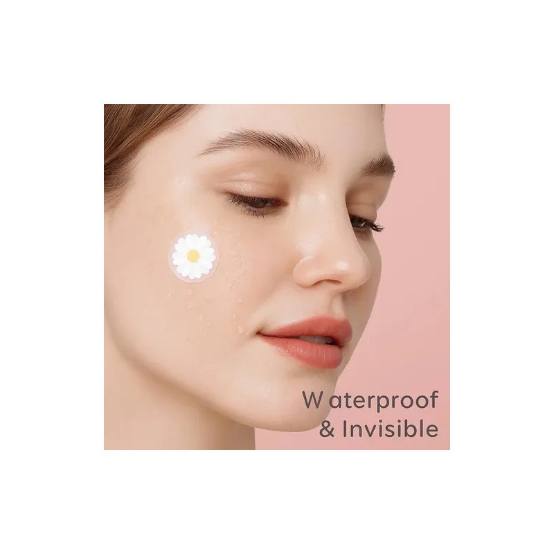 40/80/100/200pcs Pe Acne Patch Skincare Cute Design