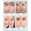 MIBIITTY Beauty Led Mask, Led Face Mask Light Therapy