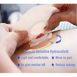 20 Pcs Flexible Ostomy Barrier Strips, Adhesive Seal Strips for Colostomy Bags, Hydrocolloid Waterproof Leak, Pressure Sensitive Adhesive Tape for Ileostomy Bags, Urostomy Barrier Tape Ostomy Supplies