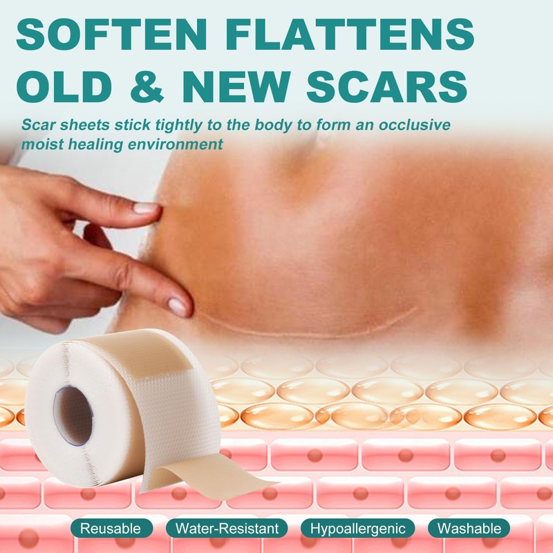 Silicone Scar Sheets, Silicone Scar Tape(1.6"x 158"), Scar Tape for