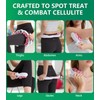Uoxfill Cellulite massage tool | 360°removable cellulite remover for legs