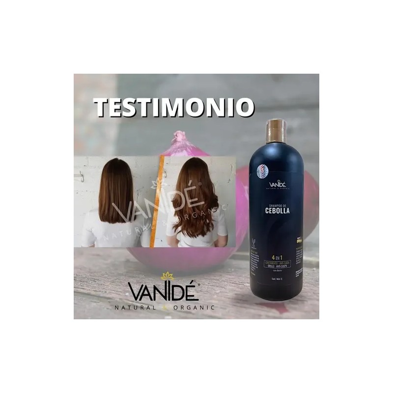 Shampoo de Cebolla Anticaída 2 Pack Onion Anti-Hair Loss Shampoo,