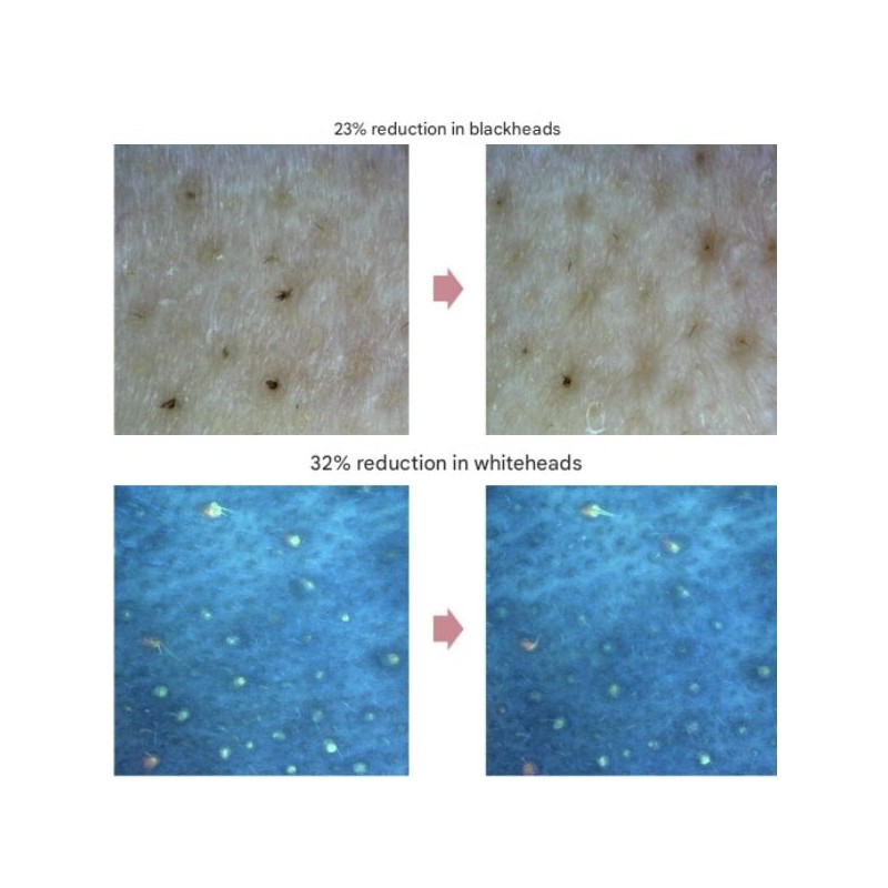 BIODANCE Collgen Cleansing Oil 200ml