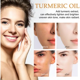 Kurkuma-Öl Whitening Oil, Whitening Kurkuma Serum Kurkuma-Öl Body Oil Ätherische Öle Für Die Hautpflege Turmeric Whitening Oil, Oil For Lightening Dark Skin Zur Korrektur Dunkler Flecken
