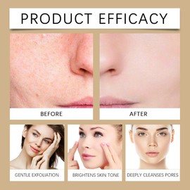 Peel Shot Glow Rice Ampoule,Facial Scrub Exfoliator,Peeling Rice Exfoliant Ampoule,Peel Shot for Face,Soft Exfoliating Face and Body Scrub,Removes Dead Skin,Hydrating Formula for All Skin Types(Rice)