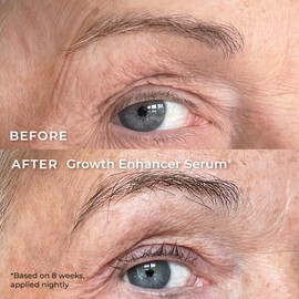 Wunderbrow Growth Enhancer Brow & Lash Serum, 2-in-1 Growth Serum For Fuller, Thicker, Healthier Brows & Lashes, Clinically Tested Formula, Visible Results in 6-8 weeks