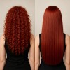 GS Hair Surgery Treatment for Red Hair /Cirugia Capilar para