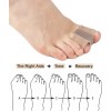Golbylicc Bunion Toe Separators for Overlapping Toes Women Men, Gel
