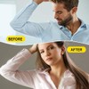 Pack of 100 Antiperspirant Pads Disposable Anti-Hyperhidrosis Underarm Plasters for