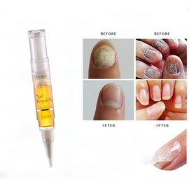 2 Pack Nail Repair Pen,Visualsource 5ML Nourishment And Repair Moisturize Uneven,Dry,Dull Nail Toe Nail Soft Manicure Health Accessories Nail Renewal