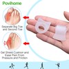 Povihome 10 Pack Clear Toe Spacers, Big Toe Separator (1st/2nd