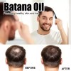 Aceite De Batana Para Crecimiento Del Cabello Hidratada 3pcs