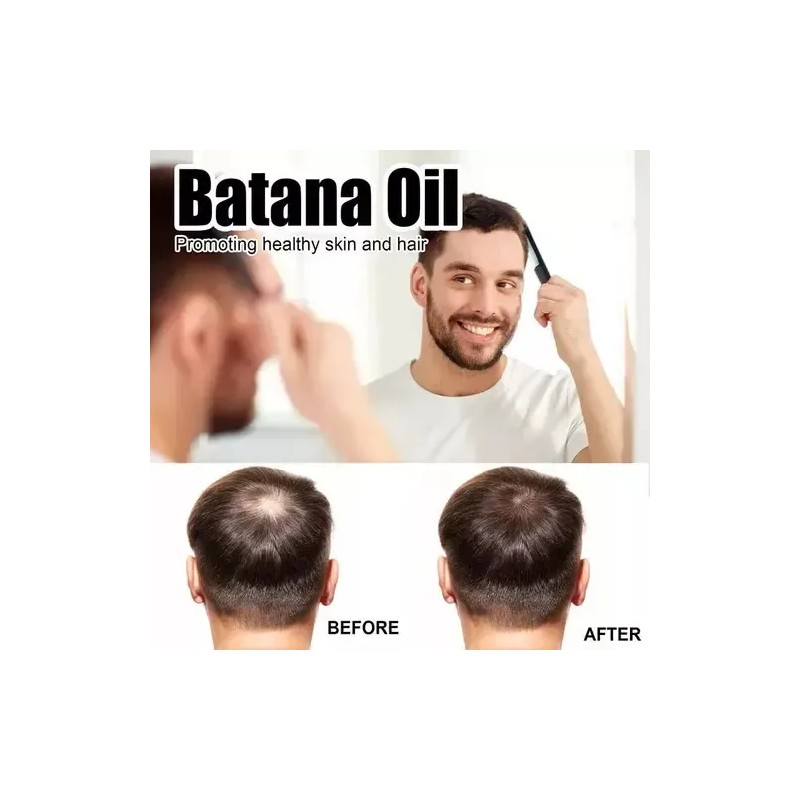 Aceite De Batana Para Crecimiento Del Cabello Hidratada 3pcs