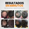 Henrys Kit Fibras Capilares Negro 27.5g con Aplicador, Disimula Áreas