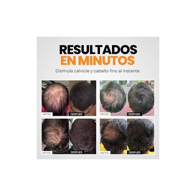Henrys Kit Fibras Capilares Negro 27.5g con Aplicador, Disimula Áreas