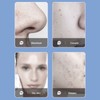 Facial Oxygen Injector 3 Gears 6 Suction Heads Vacuum Negative