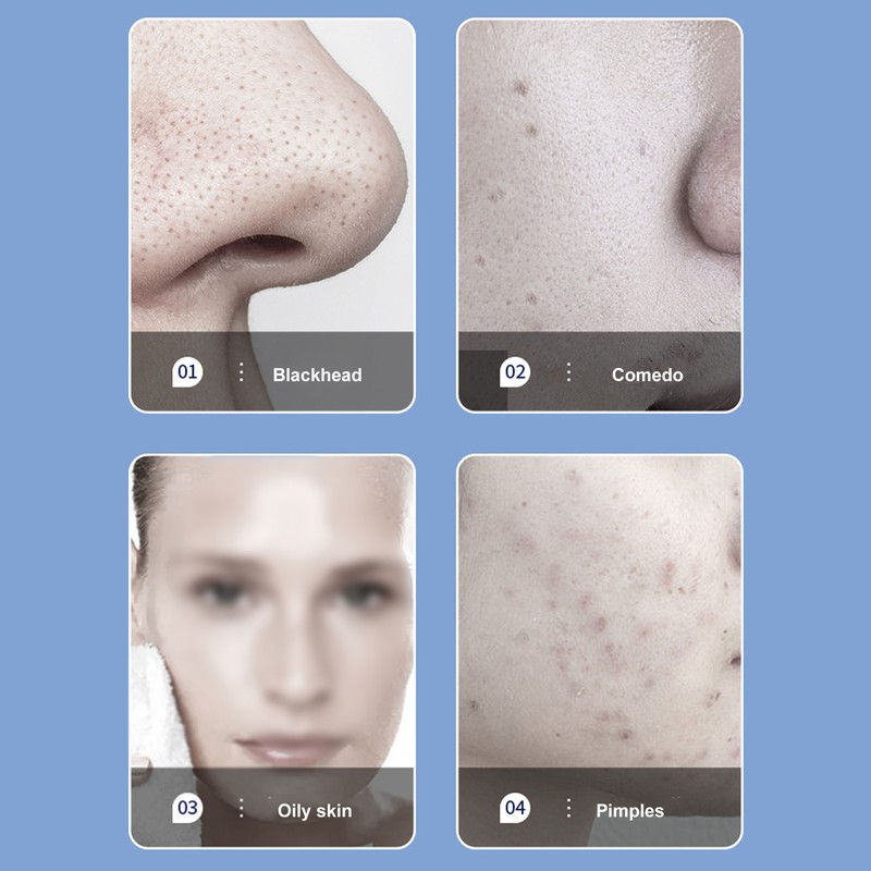 Facial Oxygen Injector 3 Gears 6 Suction Heads Vacuum Negative