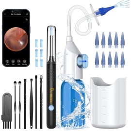 VITCOCO 1920P HD Ear Camera – USB Rechargeable Wax Removal Kit with 10 Replaceable Tips