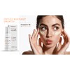 Mesoderm RX Anti Sun Spots, 50ml