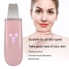 Ultrasonic Skin Scrubber Blackhead Pimple Removal Face Pore Vibration Cleanser