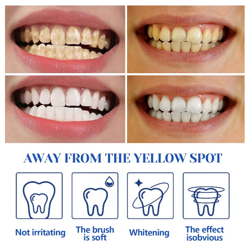 Pack of 2 Teeth Whitening Pen, Painless Teeth Bleaching for