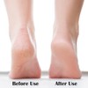 MR LION Nano Foot File - Effective Callus Remover &