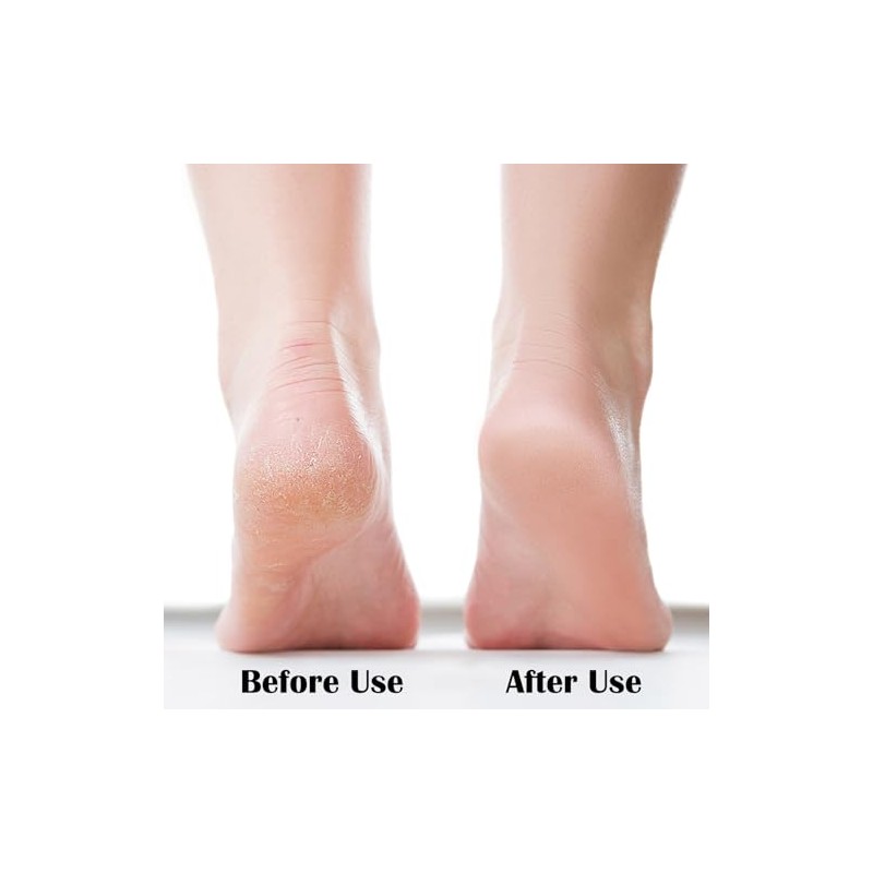 MR LION Nano Foot File - Effective Callus Remover &