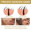 Beard Growth Kit, Beard Growth Set with Beard Roller, Beard