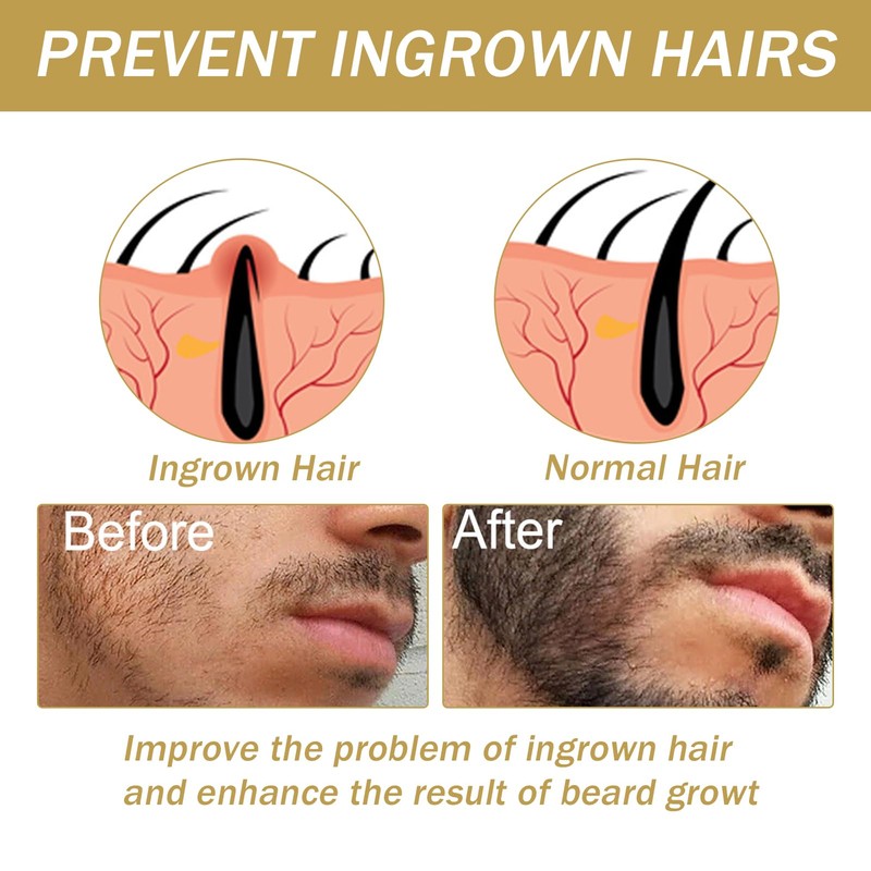 Beard Growth Kit, Beard Growth Set with Beard Roller, Beard